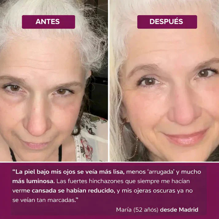 Bálsamo Koreano MultiBalm - Para Eliminar Arrugas y Líneas de Expresión