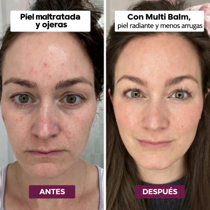 Bálsamo Koreano MultiBalm - Para Eliminar Arrugas y Líneas de Expresión